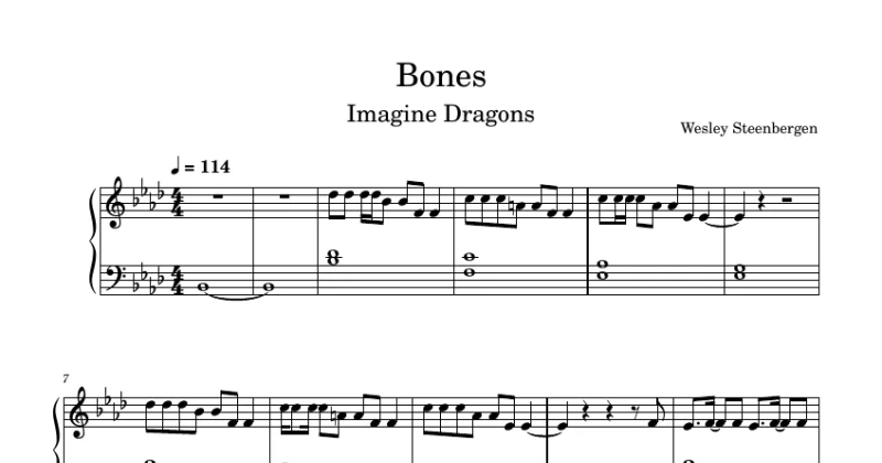 Bones